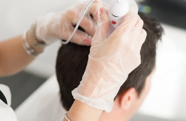 Pérdida de cabello puede ocultar alteraciones en la tiroides, alerta especialista