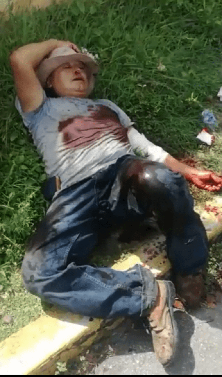 Grave fractura expuesta sufre jornalero tras caer de una barda