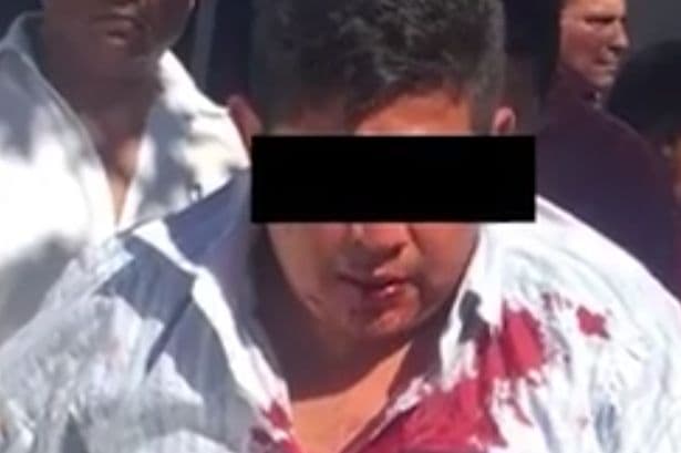 Asaltante pasa a ser víctima; lo mandan al “Torito”