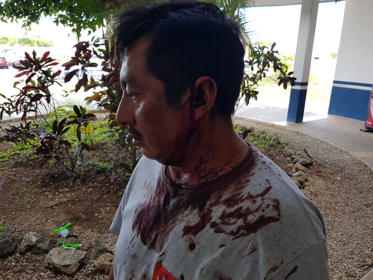 Intento de desalojo deja un muerto, dos heridos y 34 detenidos