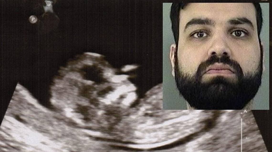 Sentencian a Doctor que a escondidas suministró una píldora abortiva a su novia