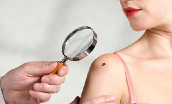 Importante observar el cuerpo para detectar señales de cáncer