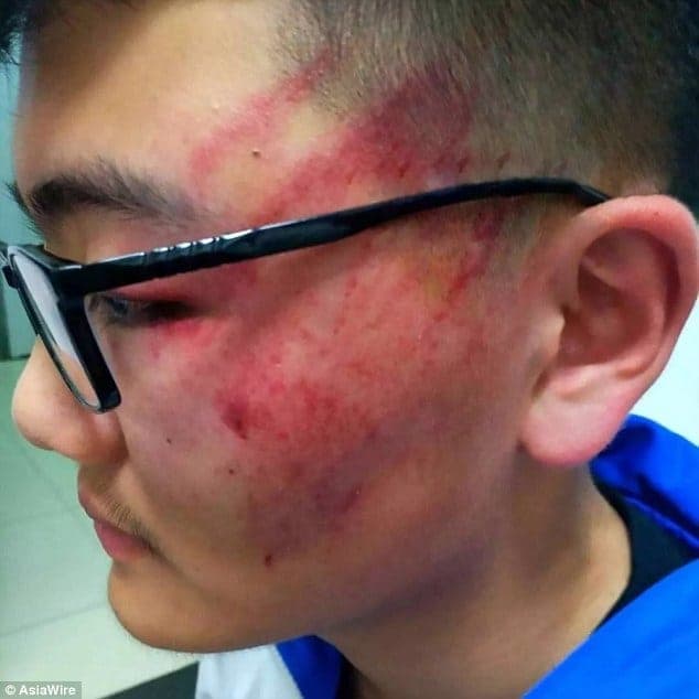 Profesor abofetea a su alumno hasta dejarlo con una conmoción cerebral