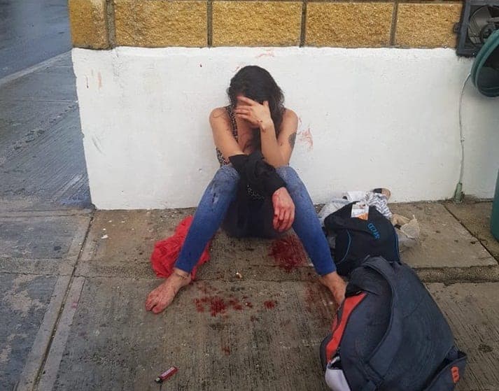 Joven cacha a su novio con otra y se corta el brazo