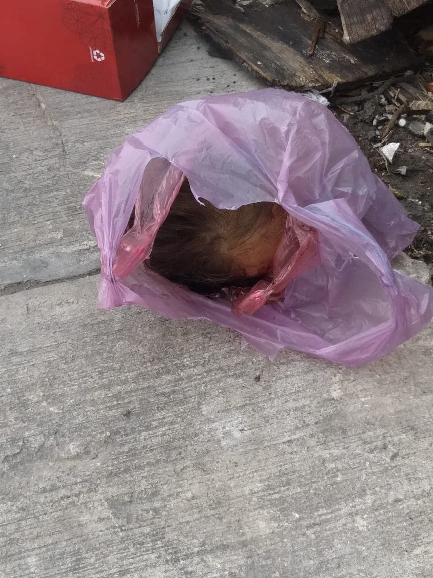 Hallan cabeza de mujer en Benito Juárez