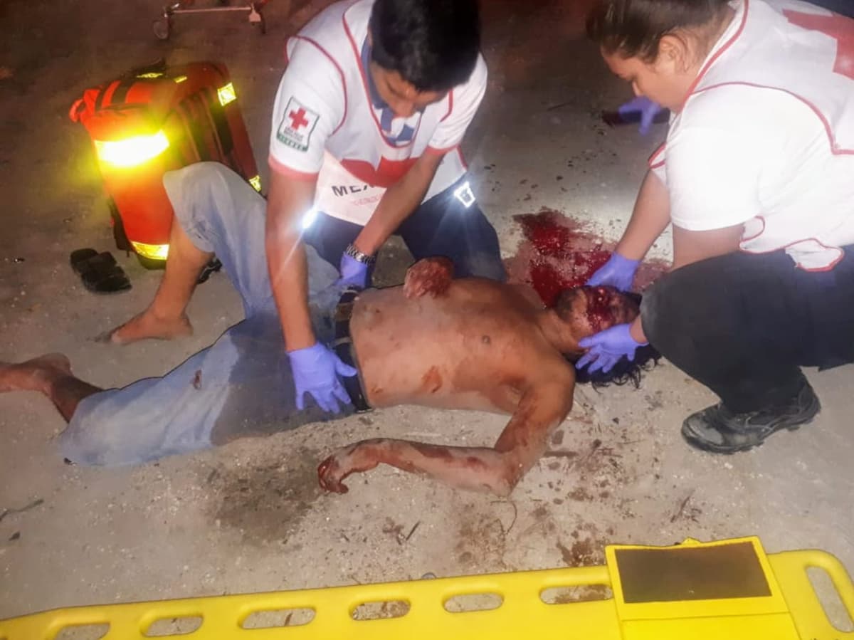 Se fractura la cabeza tras caer de un primer piso en Chetumal