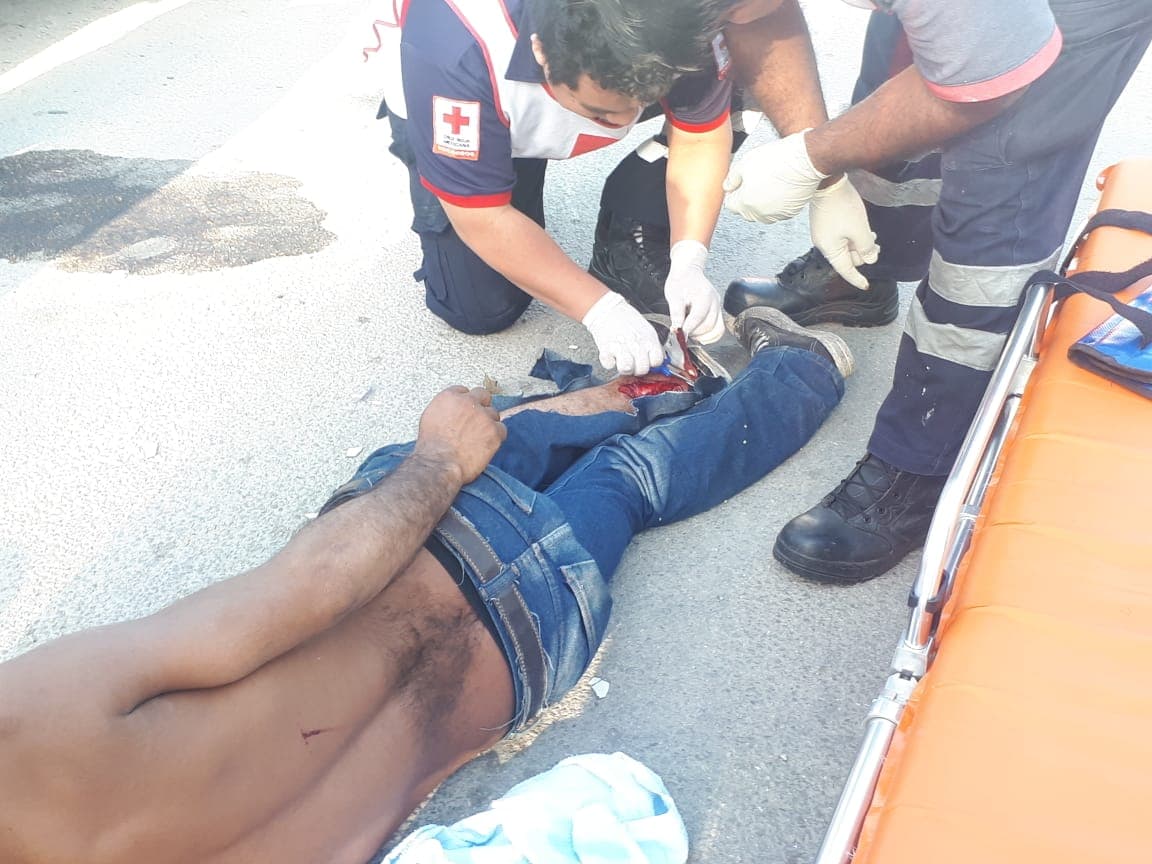 Borracho se rompe una pierna