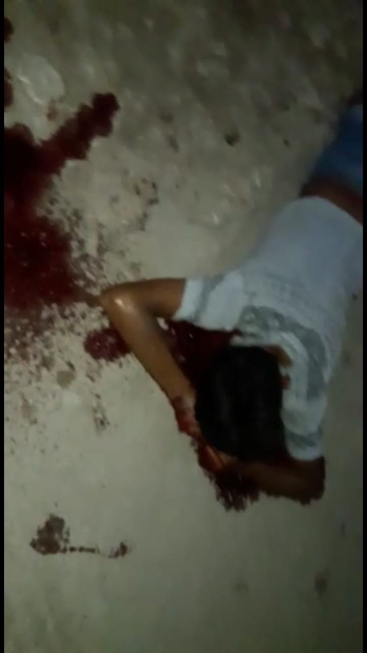 Presunto ladrón se queda sin ojo tras un accidente en Chetumal