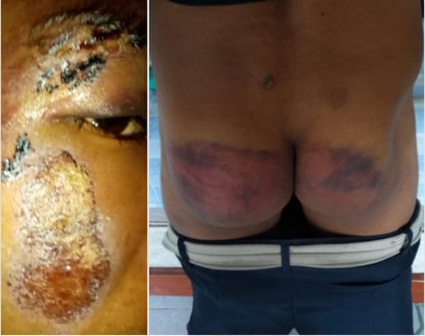 Joven es golpeado en Chetumal; acusa a policías