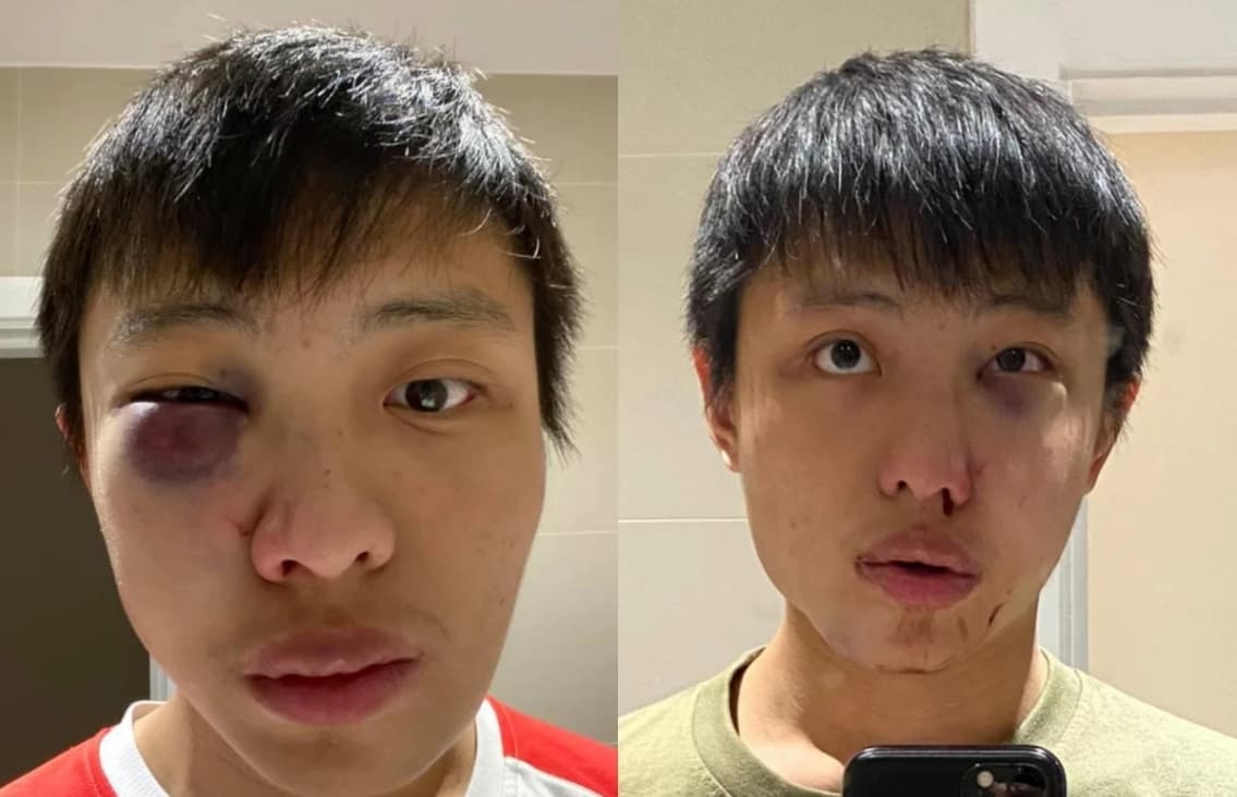 “No queremos tu coronavirus”: Golpean a estudiante asiático en Londres