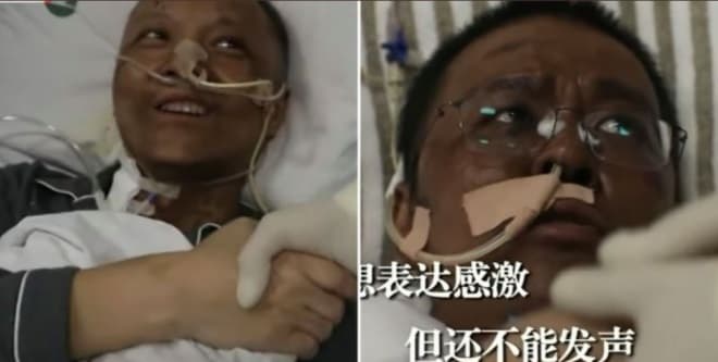 Cambian de color médicos chinos al contagiarse de Covid-19