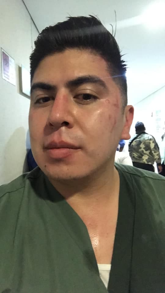Enfermero muestra heridas tras agresión de familiares de fallecido en el IMSS
