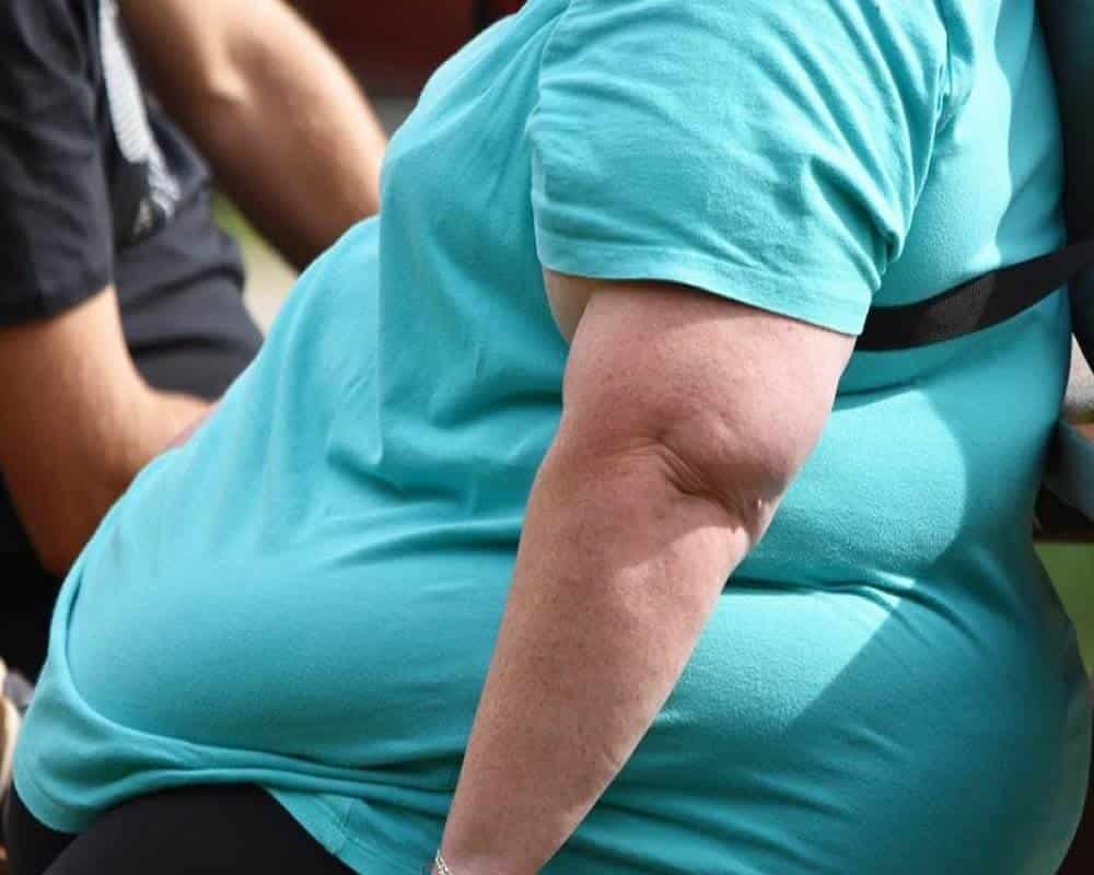 Senado avala reforma para la implementación de cirugía bariátrica gratuita