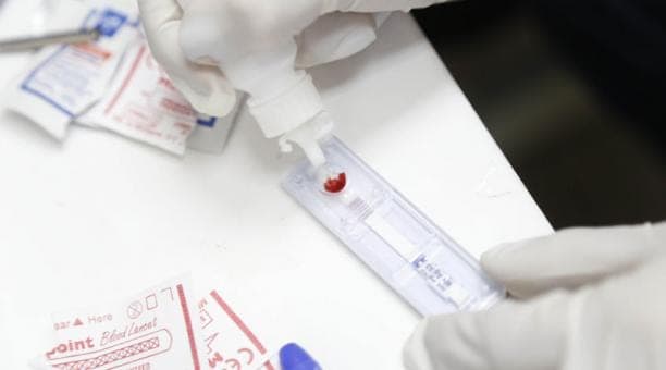 Hombres encabezan nuevos contagios por VIH en Quintana Roo