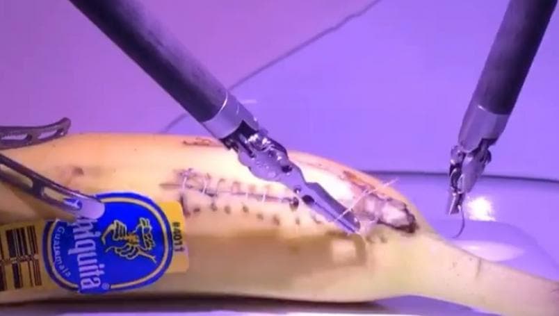 VIDEO: Médicos desde Londres operan un plátano en Estados Unidos con tecnología 5G
