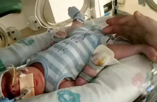 Bebé prematuro de 765 gramos venció al Covid y luego una infección intestinal