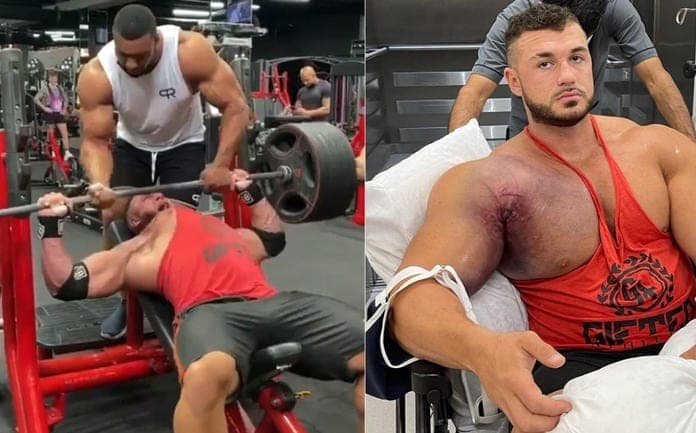 Así fue la escalofriante lesión de Ryan Crowley al arrancarse el músculo pectoral