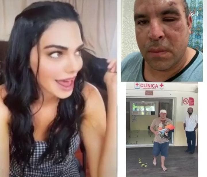 Fotógrafo recuerda un año en impunidad; golpeado y robado por actriz Livia Brito