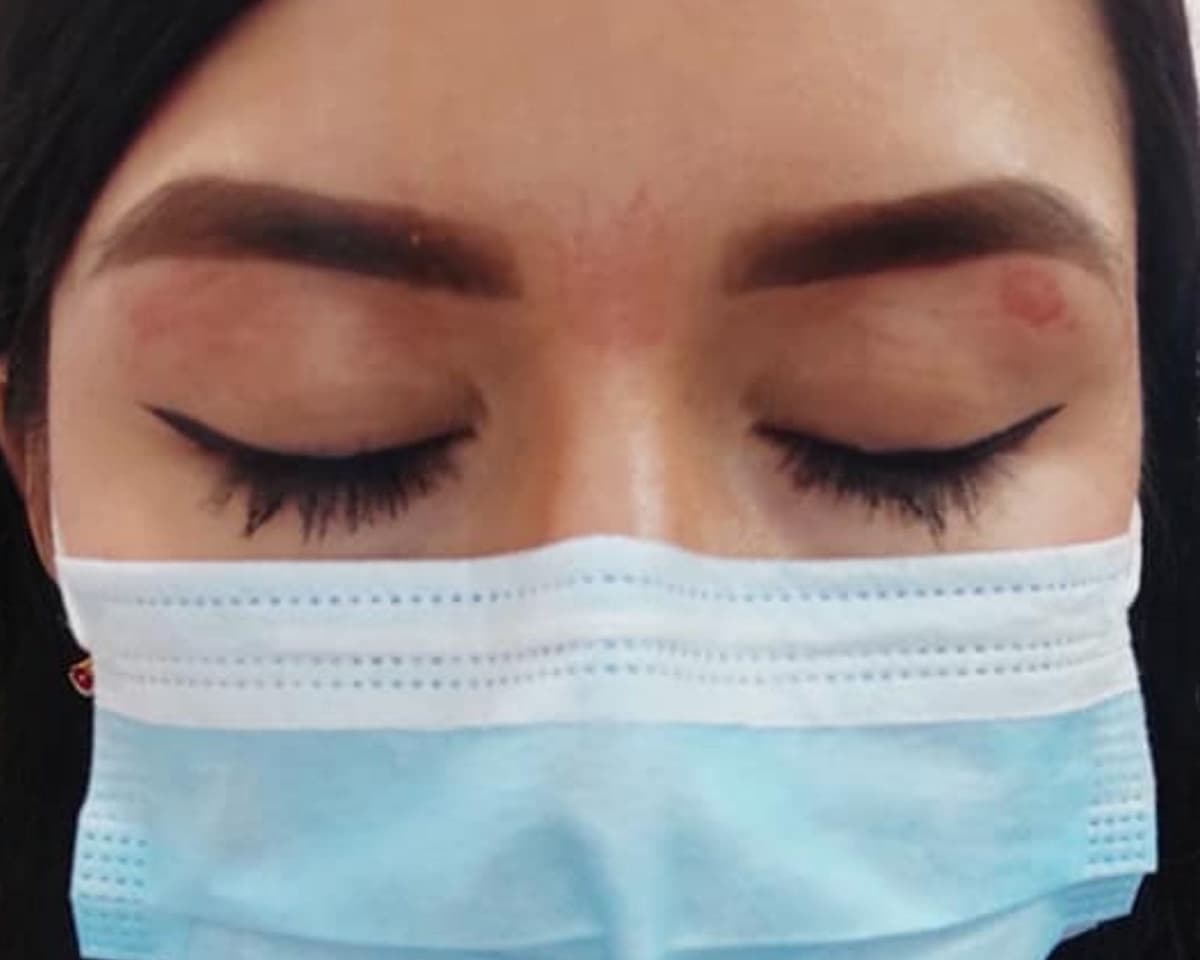 Joven denuncia a salón de belleza en Mérida por quemarle los párpados