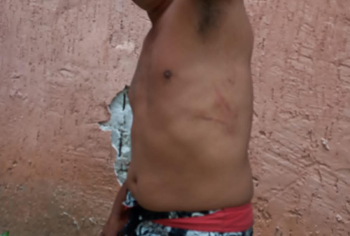 VIDEO: Ciudadano sufre abuso policial en Cancún