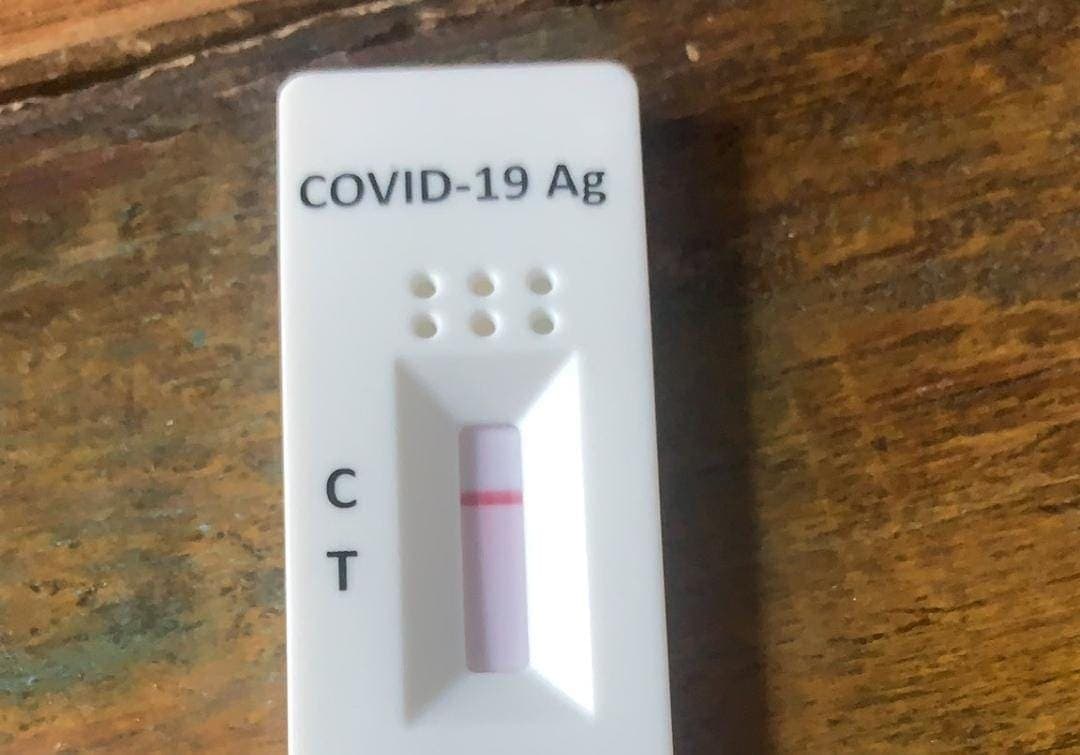 Hospital de Sydney da como negativas 400 pruebas Covid pero eran positivas