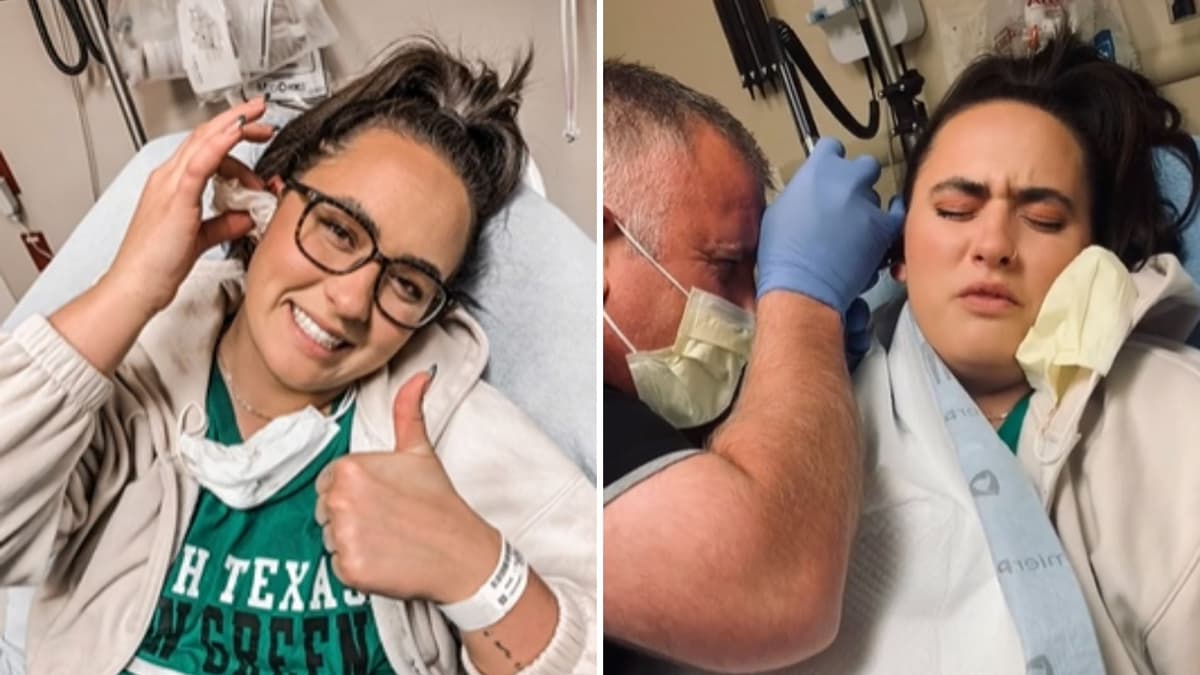 Joven va al doctor por dolor de oído, tenía un sujetador de aretes adentro