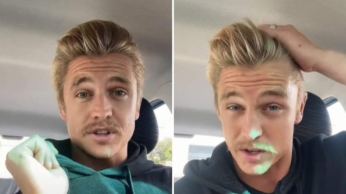 Tiktoker revela cuál es su truco para evitar quedarse calvo: seis años sin usar champú