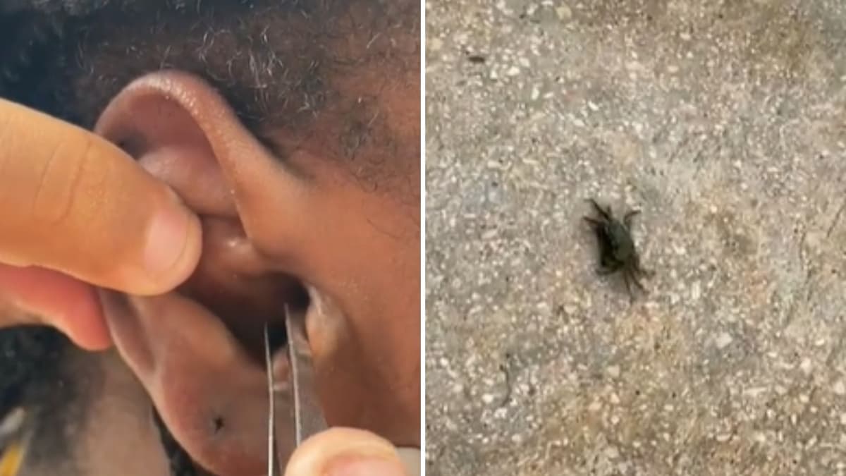 VIDEO: Cangrejo entra en el oído de turista mientras buceaba y llora de dolor al momento de sacarlo