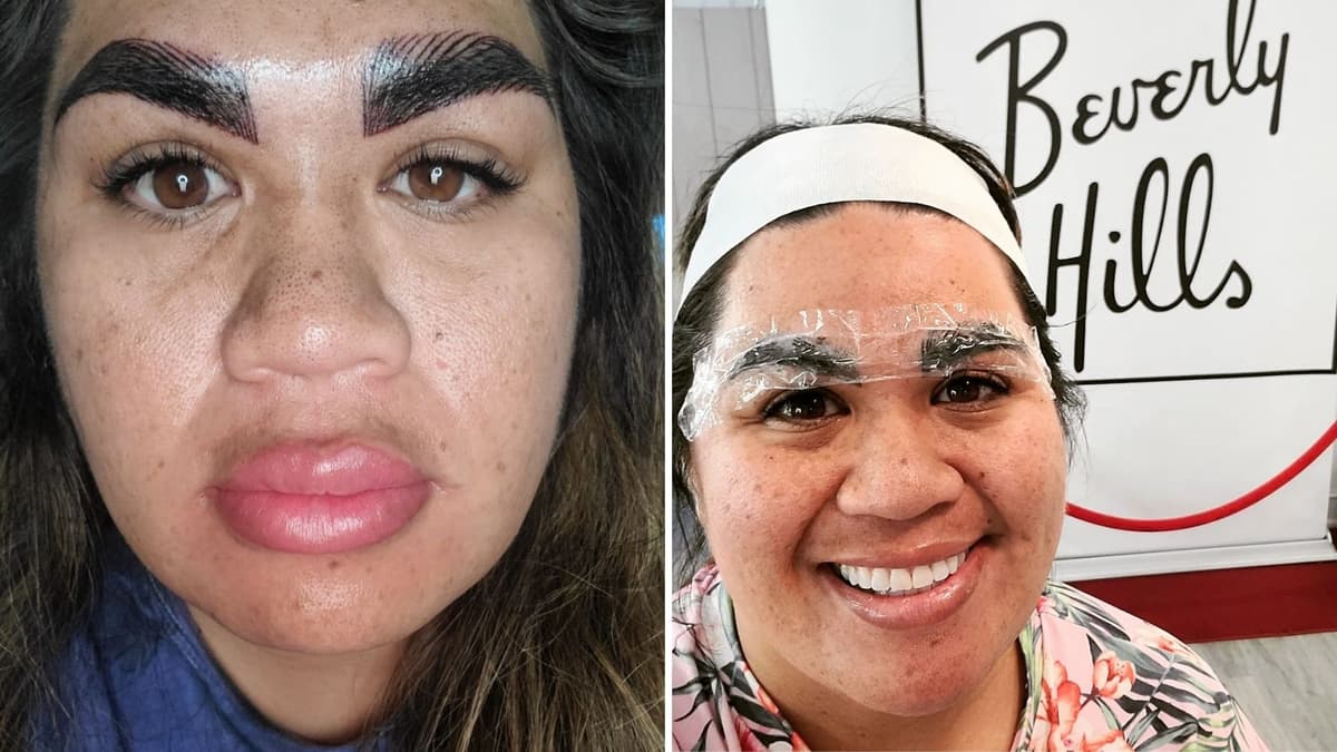 Mujer se manda a hacer un tratamiento en las cejas, el resultado termina mal