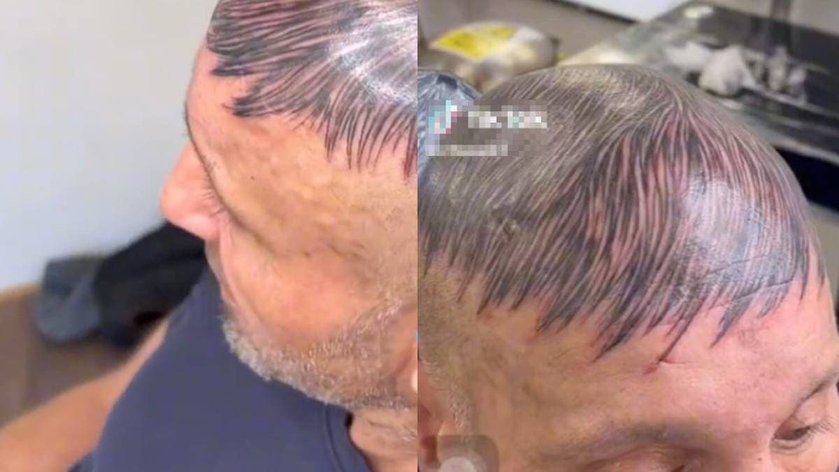 VIDEO: Hombre se tatúa la cabeza para solucionar problema de calvicie