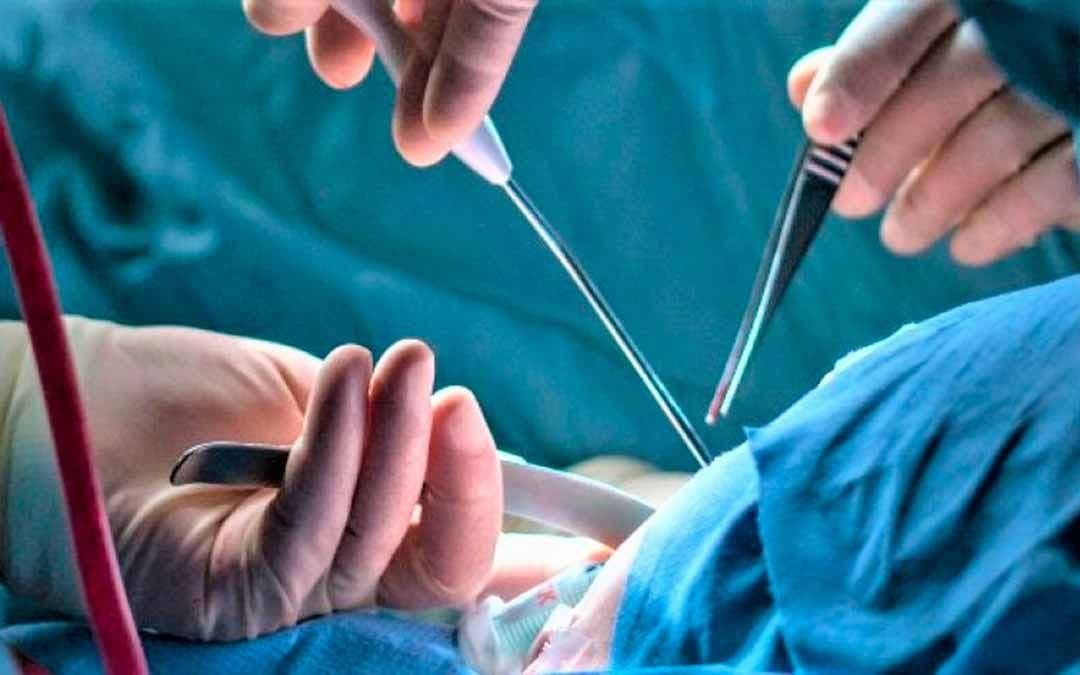 Médico deberá pagar manutención de bebé hasta los 18 años por error en vasectomía