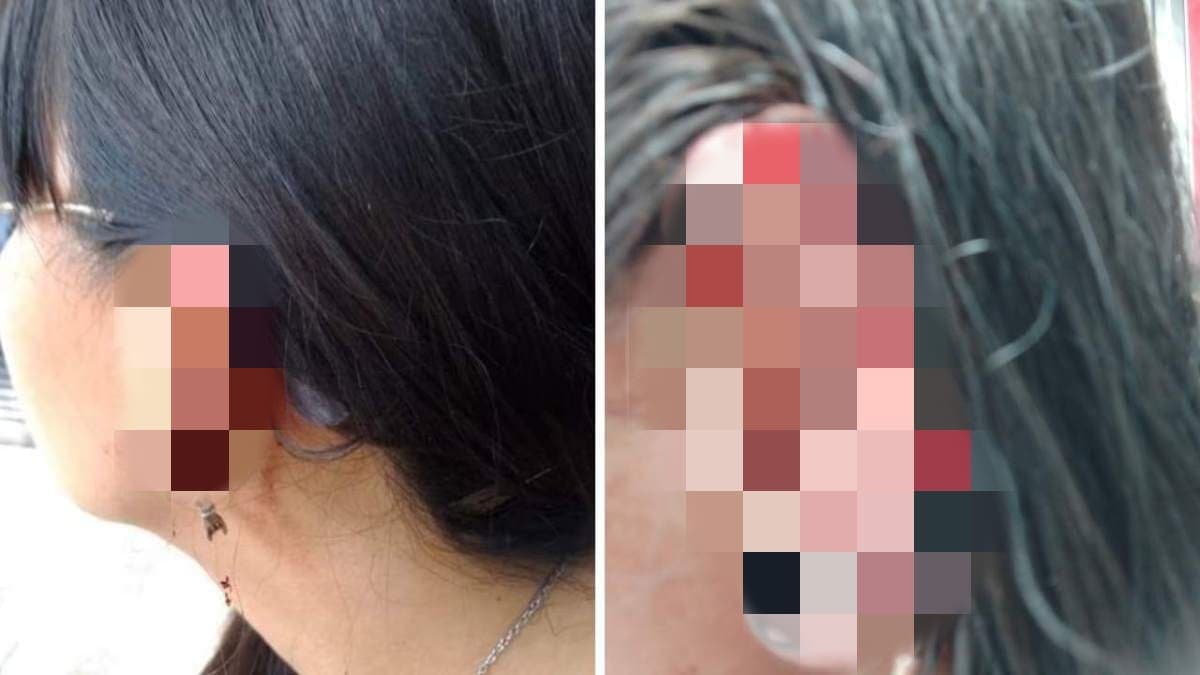 Mujer denuncia ataque de sujeto en metrobús de CDMX; le arrancó un pedazo de oreja