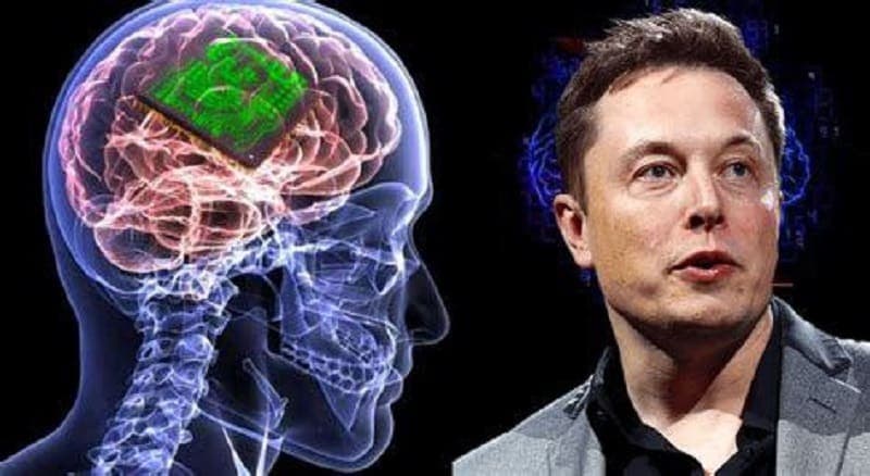 Elon Musk anunció que su empresa Neuralink implantó un chip cerebral en un ser humano por primera vez