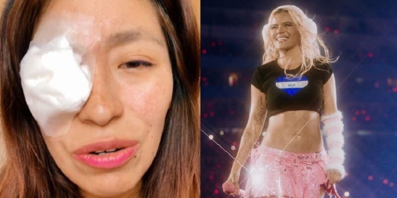 Fanática casi pierde el ojo en concierto de Karol G a causa de la pirotecnia