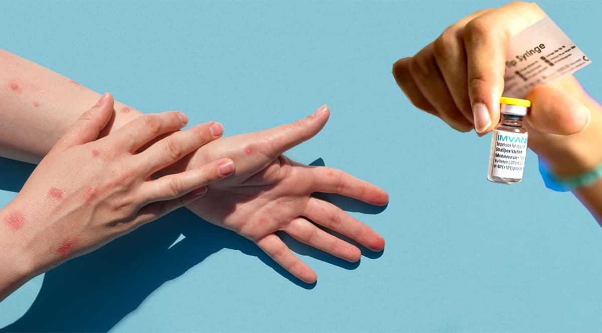 Prioridad a Quintana Roo con la vacuna contra viruela del mono por su potencial turístico