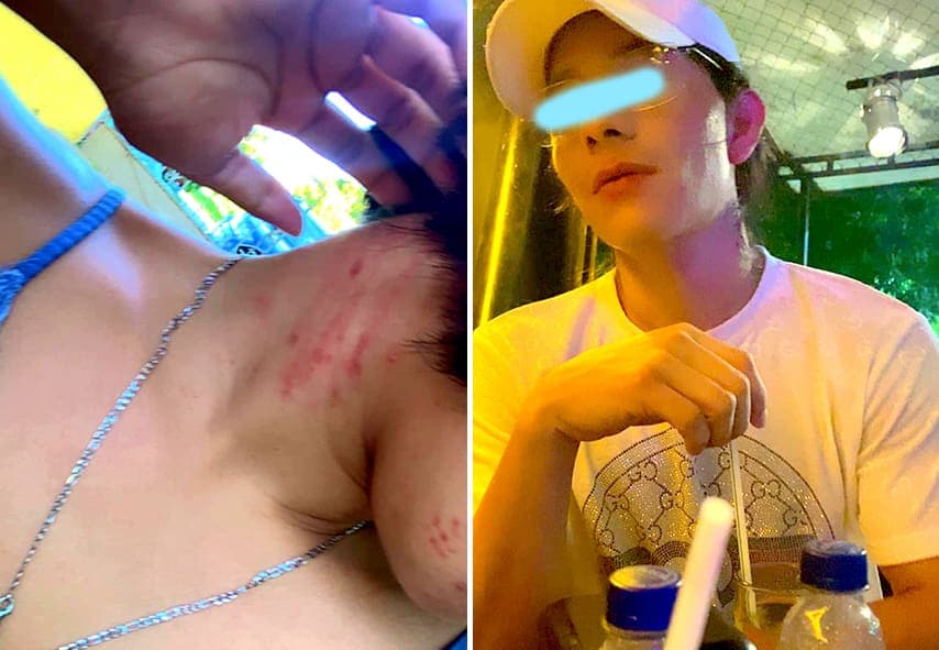 Video: Joven denuncia intento de feminicidio en Chetumal; la FGE minimiza el hecho