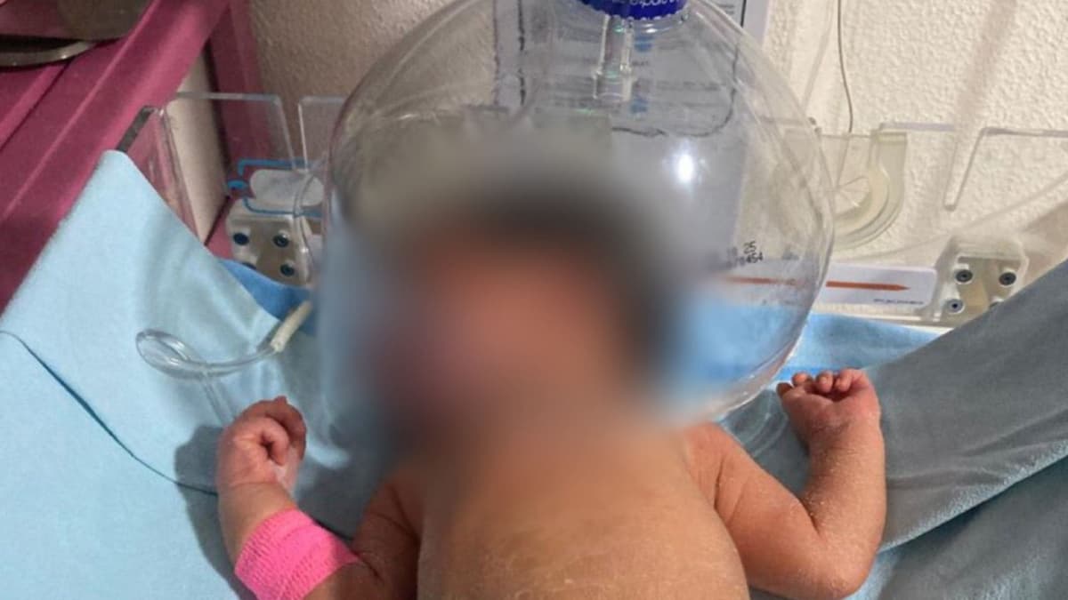Hospital Comunitario de Tabasco utiliza botella de plástico para atender a un recién nacido