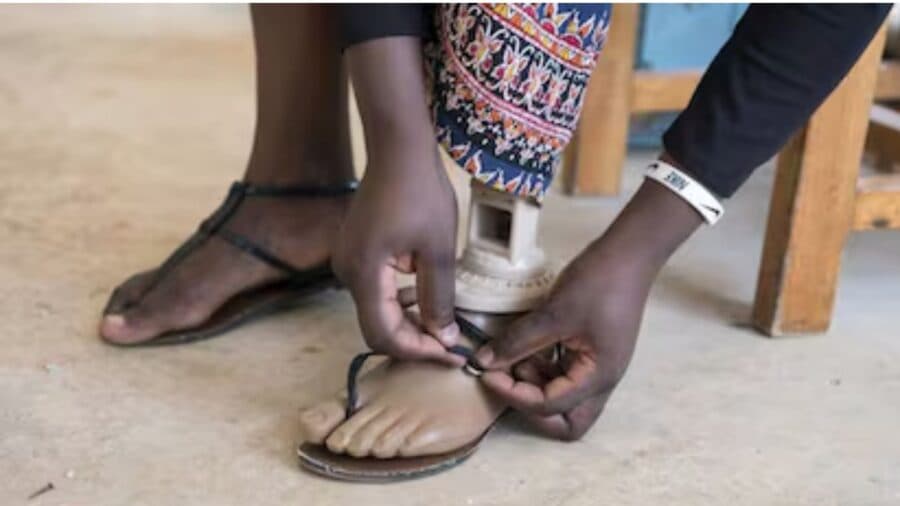 Joven se amputa un pie para ingresar a la facultad de medicina como persona con discapacidad en India