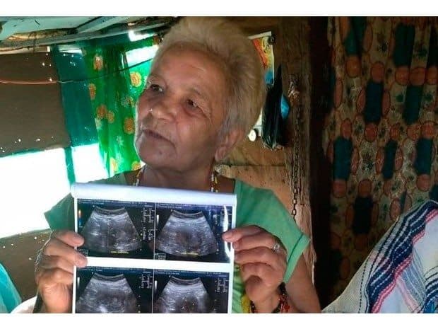 Una mexicana podría ser la mujer más longeva en dar a luz