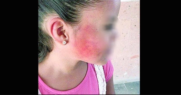 Niña de ocho años huye de su casa tras palizas de su abuela