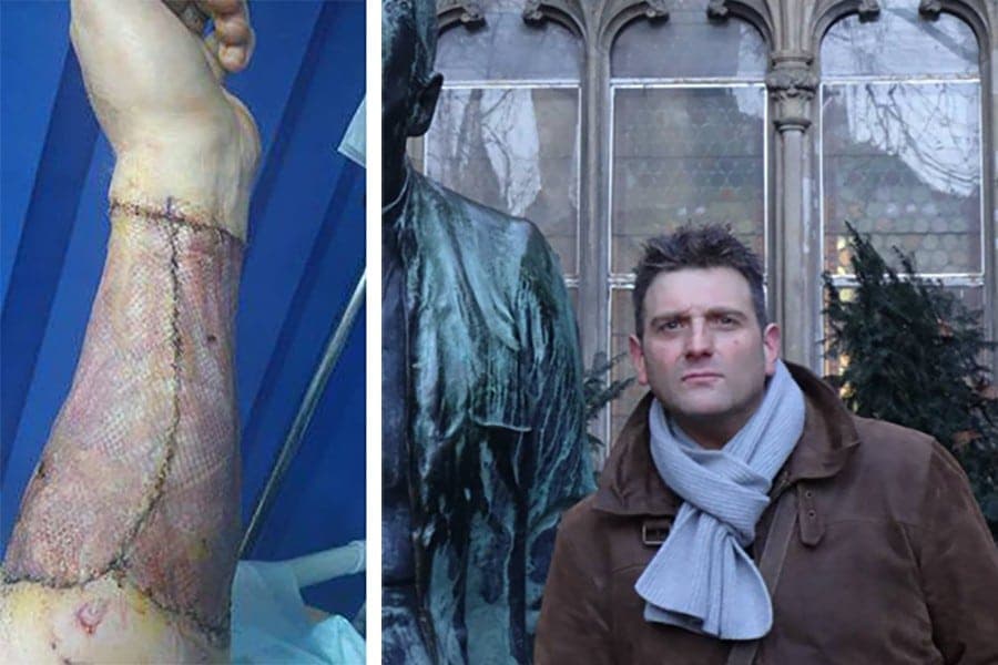 Se pone un implante de pene, pierde la virginidad y entra en coma