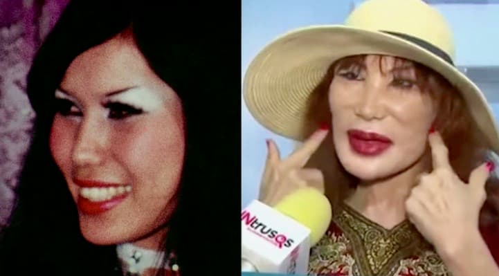 Dos cirugías, el propósito de Lyn May para 2020