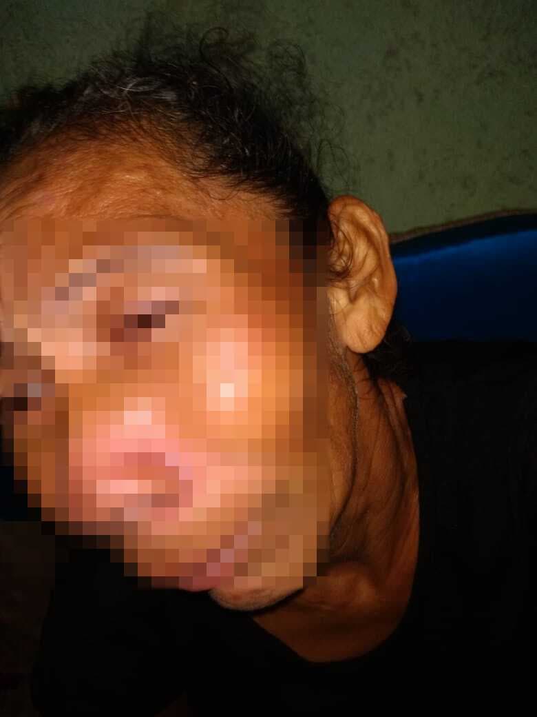 Agreden a mujer en Chetumal; policías no detienen a su agresor