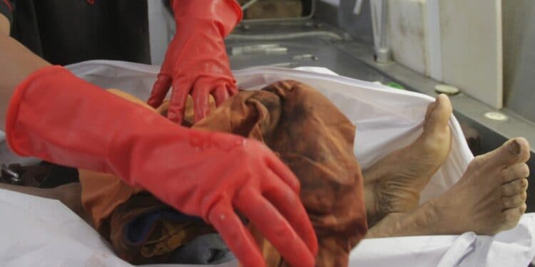 Después de varios días de agonía, muere taxista macheteado en Cancún