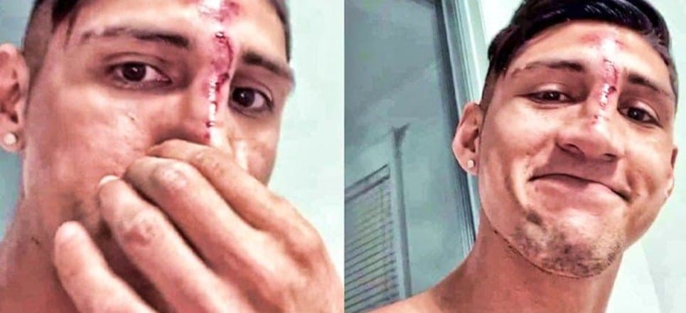 Video: Alan Pulido se rompe toda su "jefesita" tras accidente casero