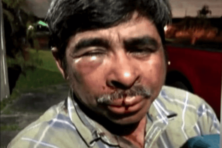 Dan brutal golpiza a mexicano mientras paseaba a su perrita en EU; denuncia racismo