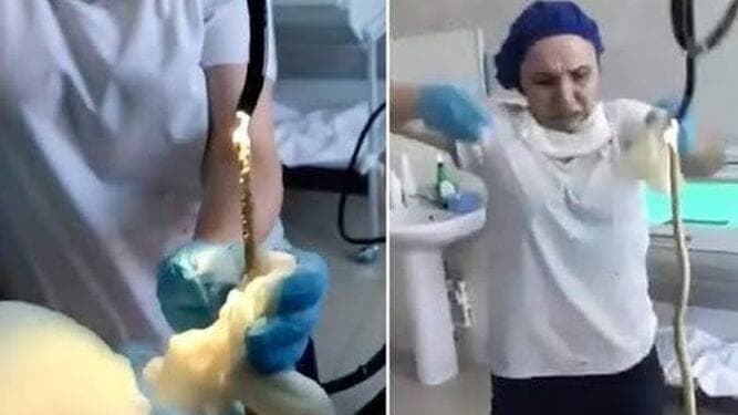 Video: Extraen serpiente de la garganta de una mujer; medía un metro de largo