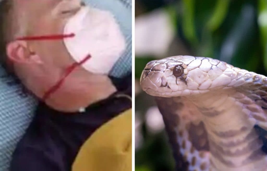 Hombre que se recuperó de la malaria, el dengue y el covid-19, es mordido por una serpiente venenosa