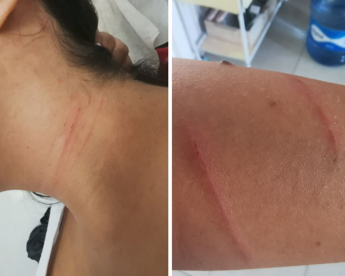 Hombre agrede a mujer en Playa del Cármen con objeto punzocortante, intentó llevársela