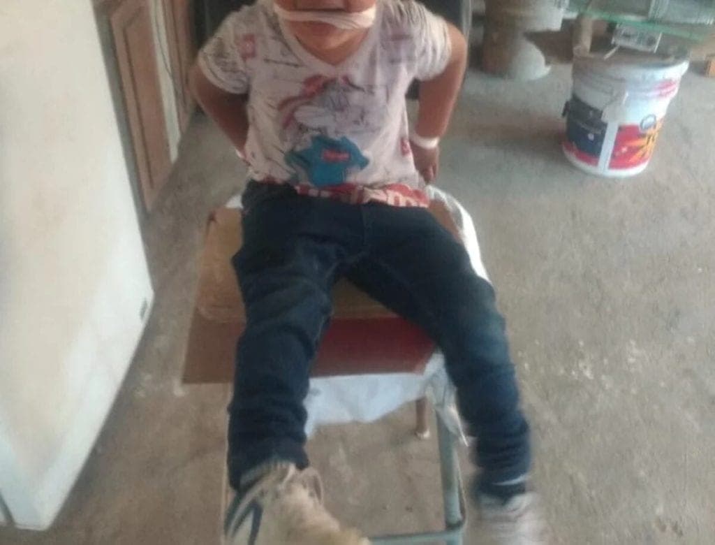 Rescatan a niño que era maltratado por sus padres, pedían dinero a cambio de no pegarle